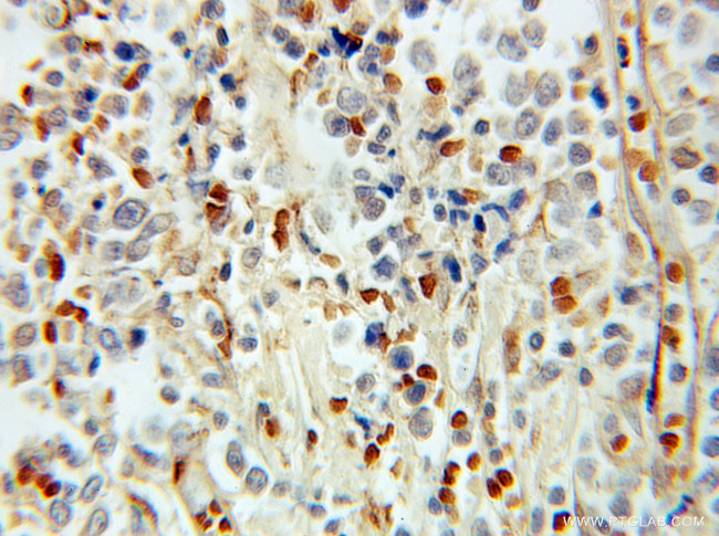 PHF11 Antibody in Immunohistochemistry (Paraffin) (IHC (P))