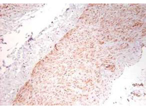 TNF alpha Antibody in Immunohistochemistry (Paraffin) (IHC (P))