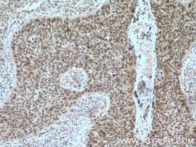 SRp20 Antibody in Immunohistochemistry (Paraffin) (IHC (P))