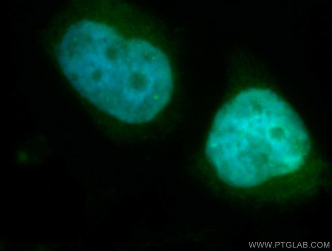 CDC27/APC3 Antibody in Immunocytochemistry (ICC/IF)