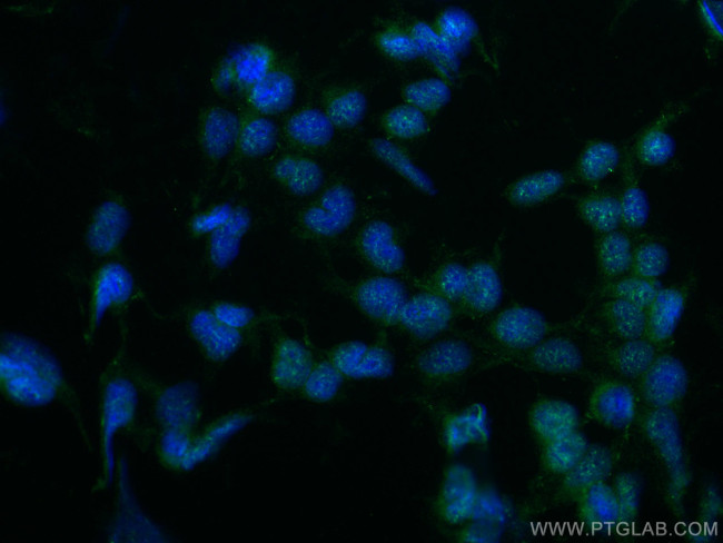 SF3B2 Antibody in Immunocytochemistry (ICC/IF)