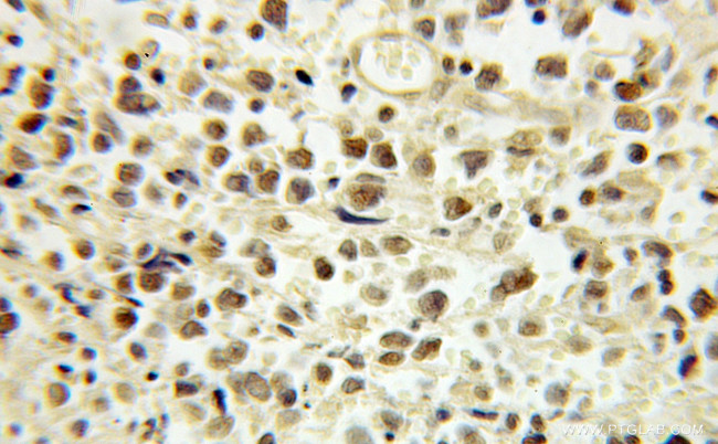 E2F4 Antibody in Immunohistochemistry (Paraffin) (IHC (P))