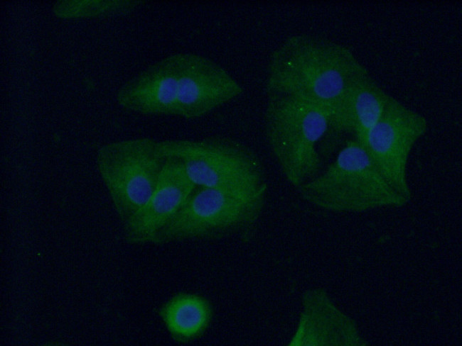 SCNN1A Antibody in Immunocytochemistry (ICC/IF)