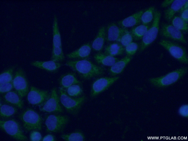 HSD11B1 Antibody in Immunocytochemistry (ICC/IF)