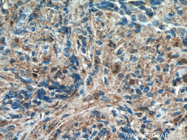 CXCL10/IP10 Antibody in Immunohistochemistry (Paraffin) (IHC (P))