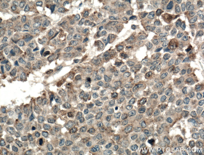 TPK1 Antibody in Immunohistochemistry (Paraffin) (IHC (P))