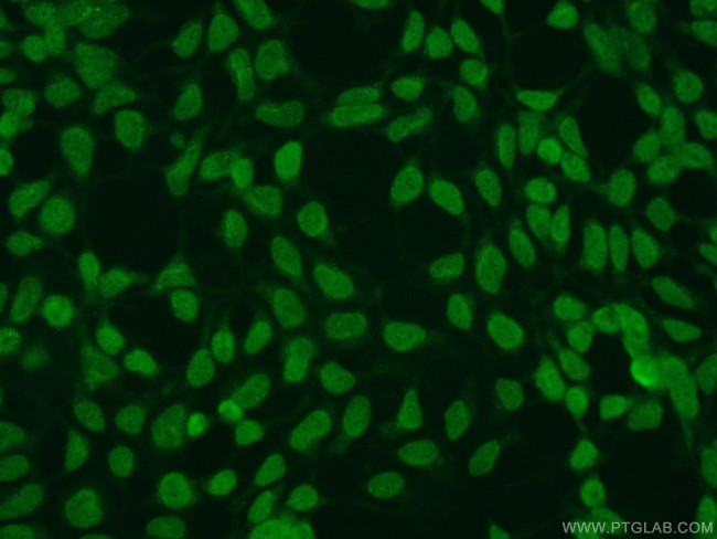 SUMO2/3 Antibody in Immunocytochemistry (ICC/IF)