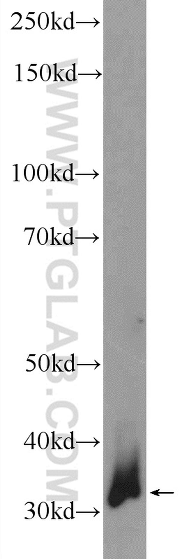 CTDSP1 Antibody in Western Blot (WB)