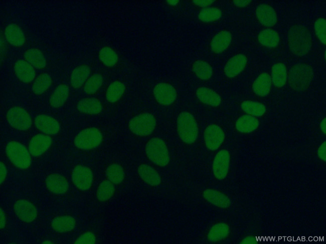 HMGN2 Antibody in Immunocytochemistry (ICC/IF)