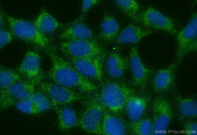 Galectin 8 Antibody in Immunocytochemistry (ICC/IF)