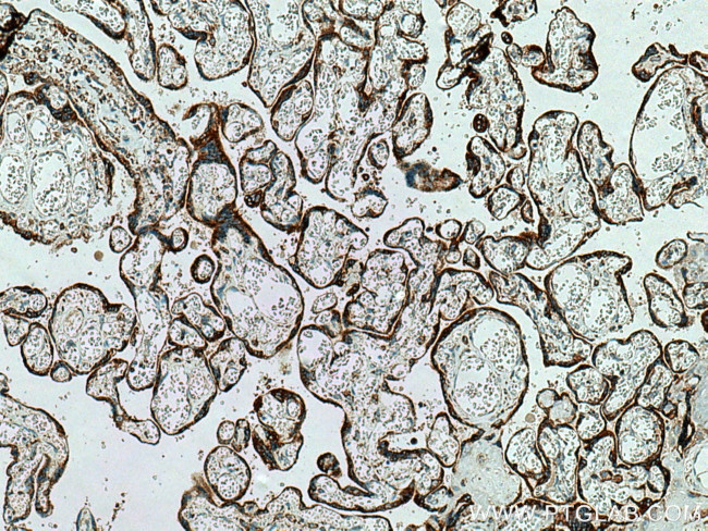 MESDC2 Antibody in Immunohistochemistry (Paraffin) (IHC (P))