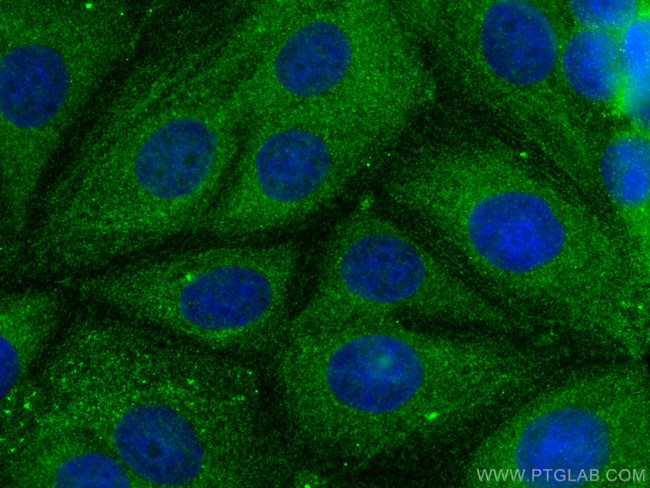 Destrin Antibody in Immunocytochemistry (ICC/IF)
