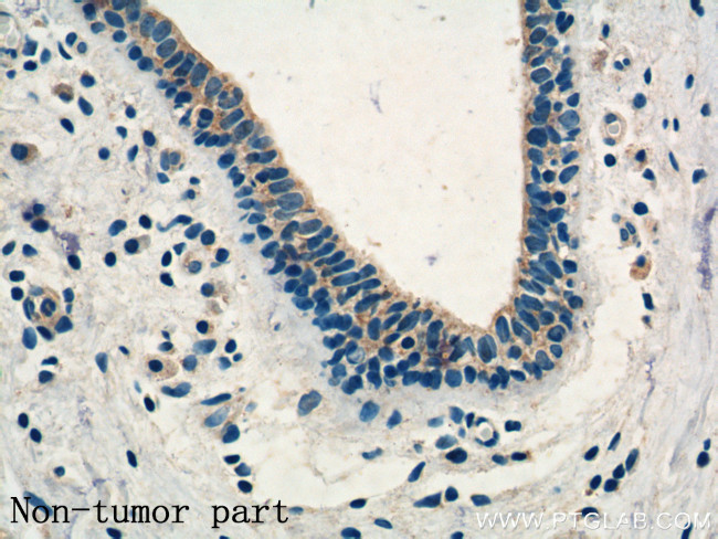 KLRG1 Antibody in Immunohistochemistry (Paraffin) (IHC (P))