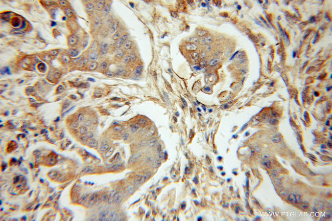 PLK3 Antibody in Immunohistochemistry (Paraffin) (IHC (P))
