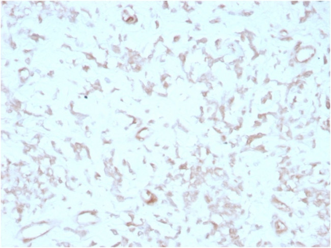 Kindlin-2/KIND2 Antibody in Immunohistochemistry (Paraffin) (IHC (P))