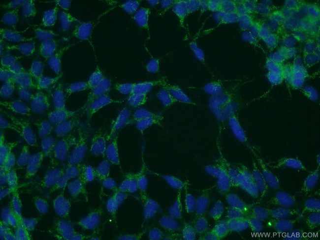 PICK1 Antibody in Immunocytochemistry (ICC/IF)