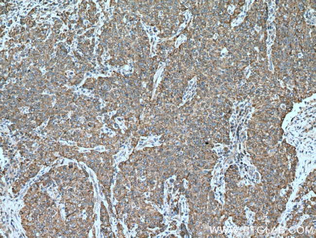 NCLN Antibody in Immunohistochemistry (Paraffin) (IHC (P))