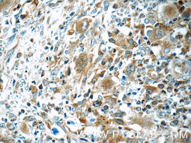 WASP Antibody in Immunohistochemistry (Paraffin) (IHC (P))
