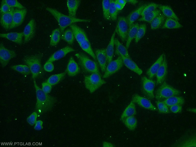 VILIP 3 Antibody in Immunocytochemistry (ICC/IF)