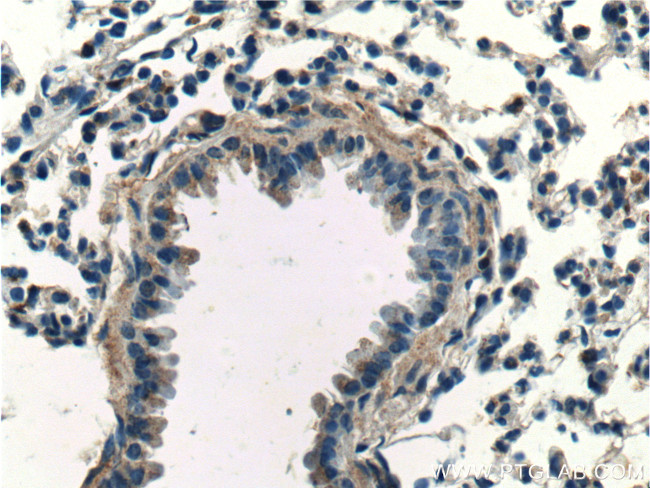 SPATA2 Antibody in Immunohistochemistry (Paraffin) (IHC (P))