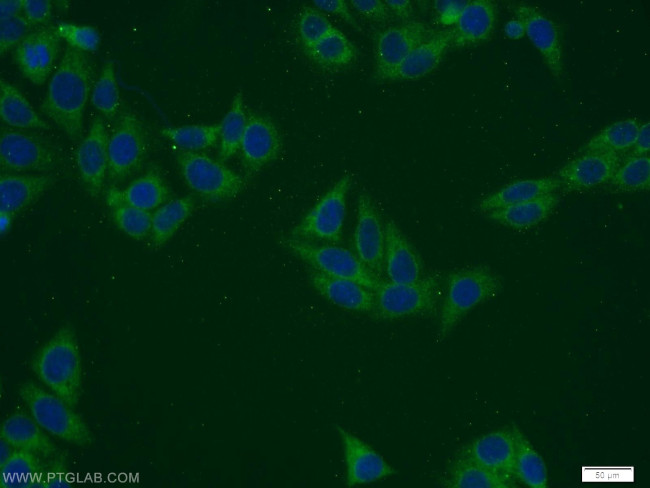 PANK2 Antibody in Immunocytochemistry (ICC/IF)