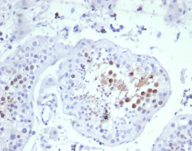 KIF2C (Kinesin Family Member 2C)/MCAK Antibody in Immunohistochemistry (Paraffin) (IHC (P))