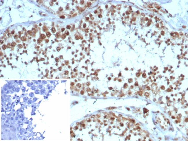 KIF2C (Kinesin Family Member 2C)/MCAK Antibody in Immunohistochemistry (Paraffin) (IHC (P))