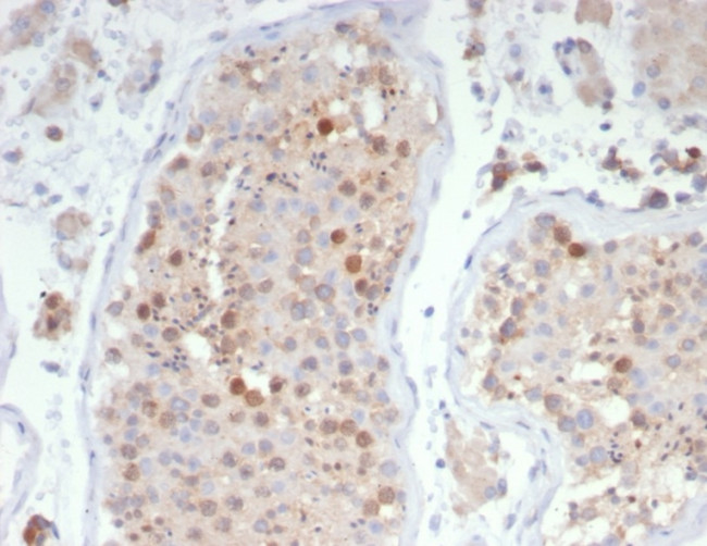 KIF2C (Kinesin Family Member 2C)/MCAK Antibody in Immunohistochemistry (Paraffin) (IHC (P))