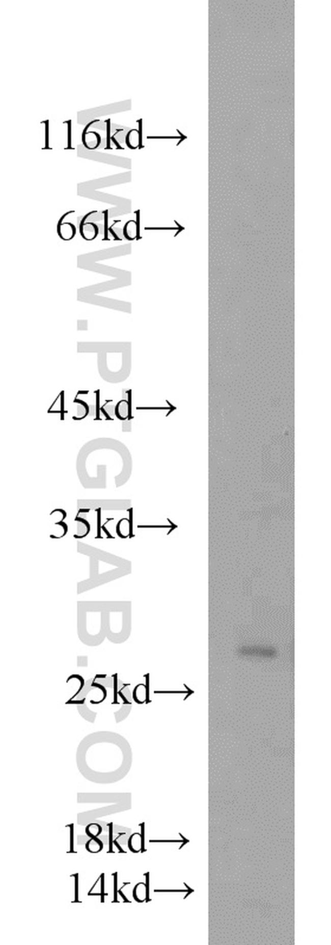 EIF4H Antibody in Western Blot (WB)