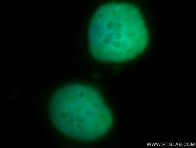 DHX16 Antibody in Immunocytochemistry (ICC/IF)
