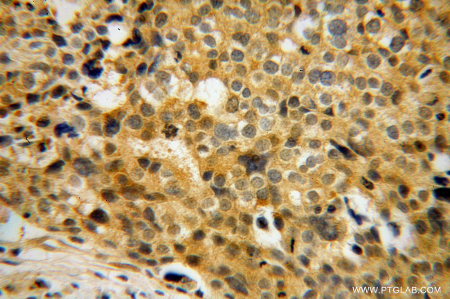 FHL3 Antibody in Immunohistochemistry (Paraffin) (IHC (P))
