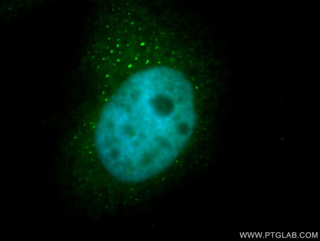 PSMB4 Antibody in Immunocytochemistry (ICC/IF)