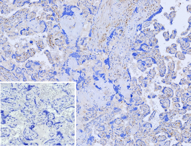 Choline Acetyltransferase (CHAT) (Marker of Cholinergic Cells) Antibody in Immunohistochemistry (Paraffin) (IHC (P))