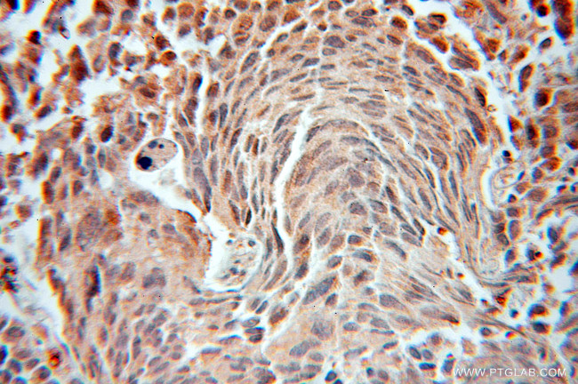 FEM1B Antibody in Immunohistochemistry (Paraffin) (IHC (P))