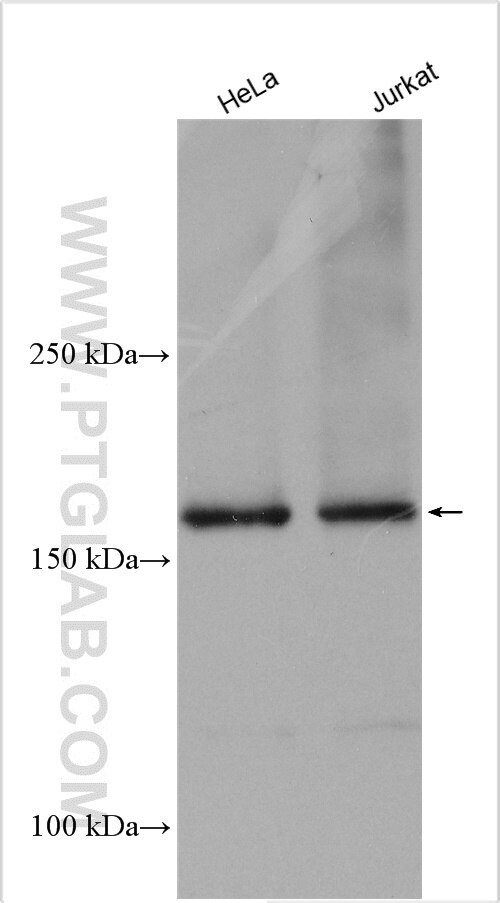 CPSF1 Antibody in Western Blot (WB)