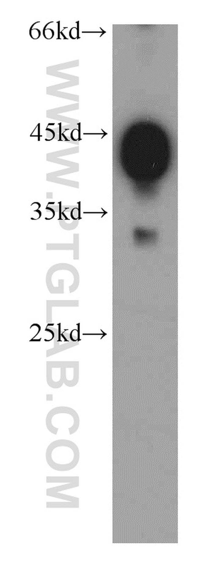 Alpha cardiac muscle actin Antibody in Western Blot (WB)