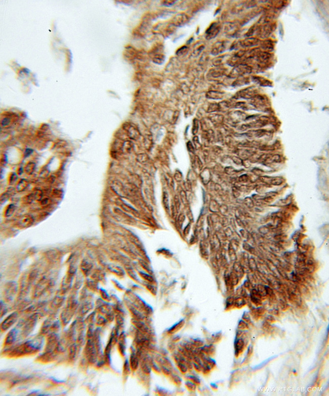 PFDN1 Antibody in Immunohistochemistry (Paraffin) (IHC (P))