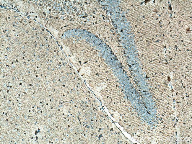 Glutamine synthetase Antibody in Immunohistochemistry (Paraffin) (IHC (P))