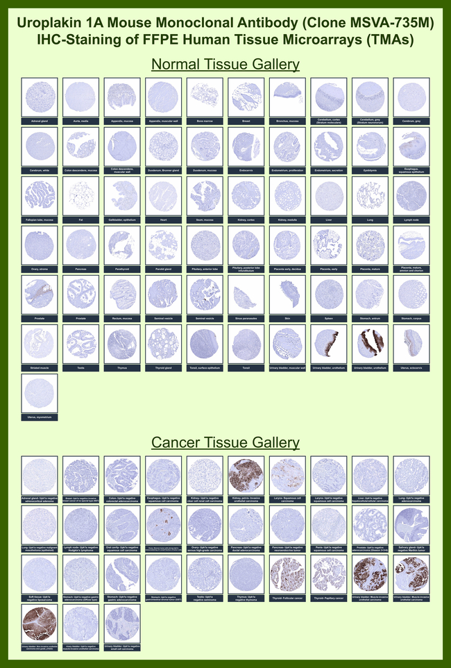 Uroplakin 1A (Urothelial Differentiation Marker) Antibody in Immunohistochemistry (Paraffin) (IHC (P))