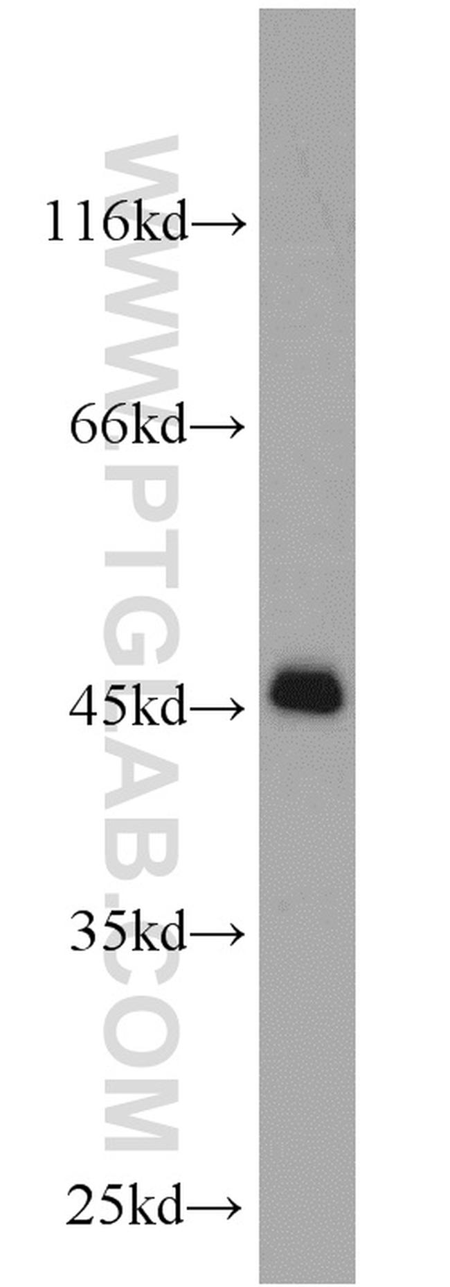 UXT Antibody in Western Blot (WB)