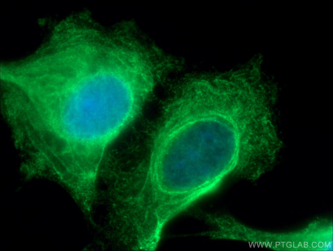 KRT33B Antibody in Immunocytochemistry (ICC/IF)