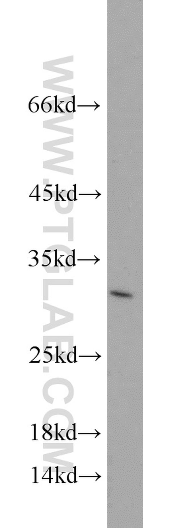 GAS41 Antibody in Western Blot (WB)
