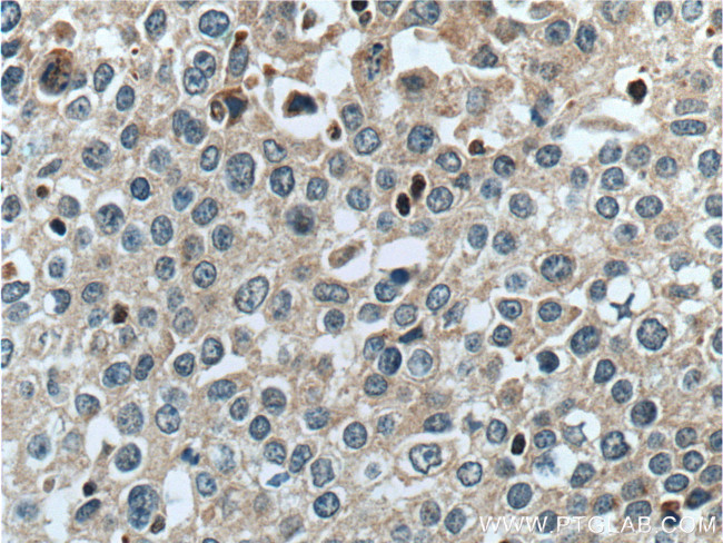RON/MST1R Antibody in Immunohistochemistry (Paraffin) (IHC (P))
