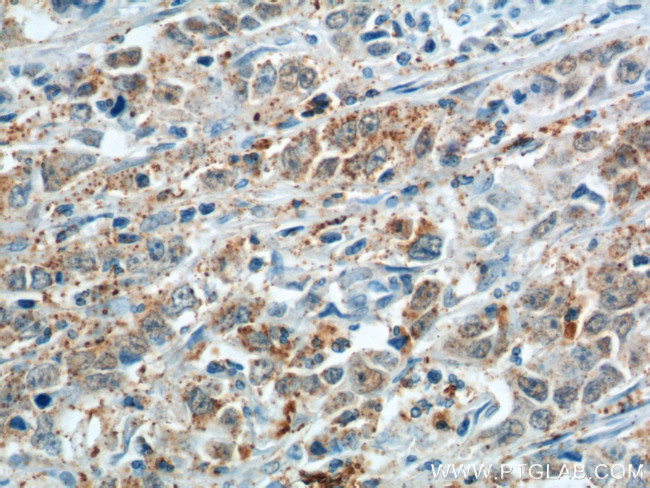 Cathepsin F Antibody in Immunohistochemistry (Paraffin) (IHC (P))