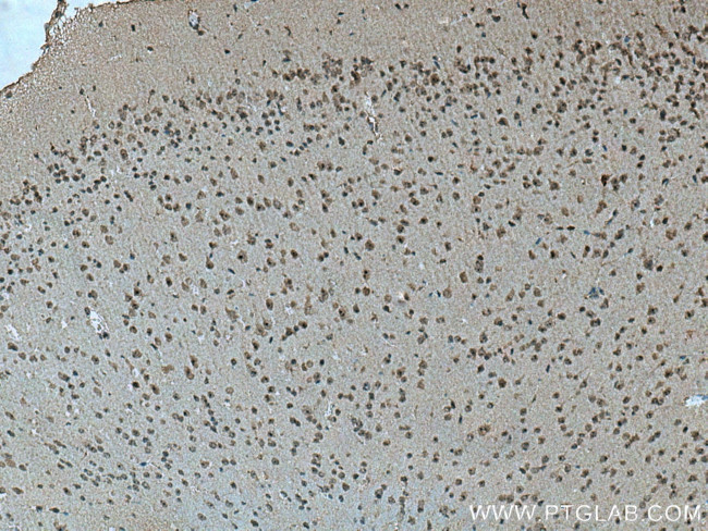 Cirhin Antibody in Immunohistochemistry (Paraffin) (IHC (P))