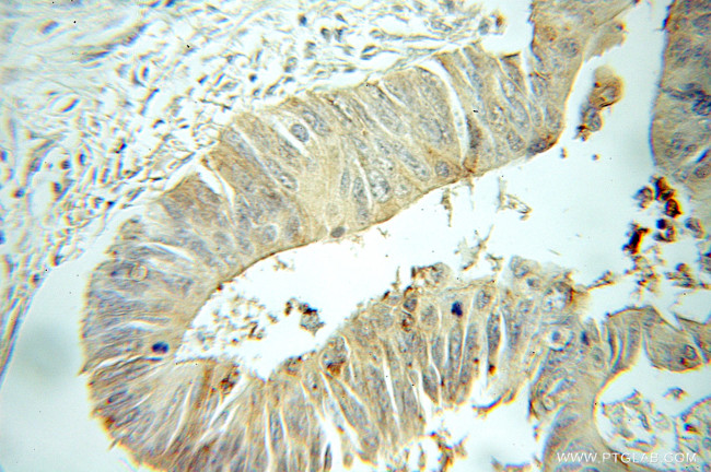 TIMM17B Antibody in Immunohistochemistry (Paraffin) (IHC (P))