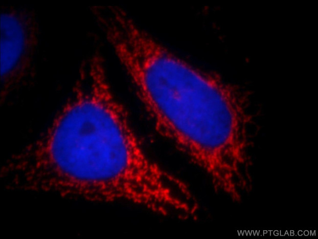 ABCB9 Antibody in Immunocytochemistry (ICC/IF)