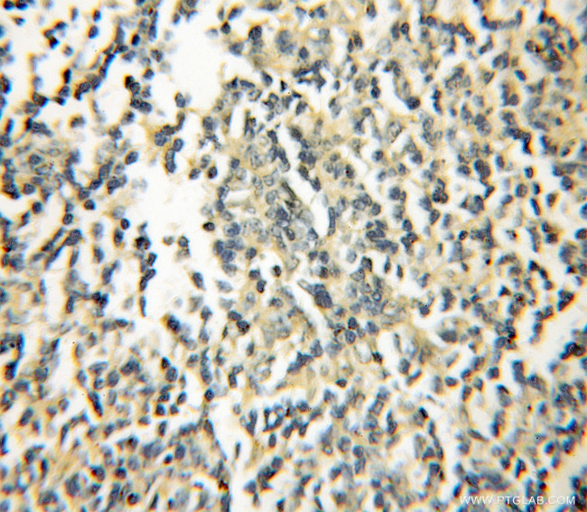 GIMAP5 Antibody in Immunohistochemistry (Paraffin) (IHC (P))