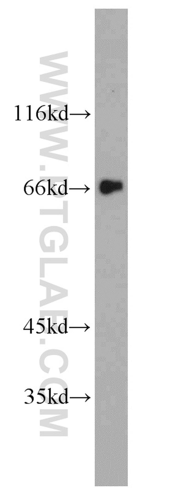 FMR1NB Antibody in Western Blot (WB)