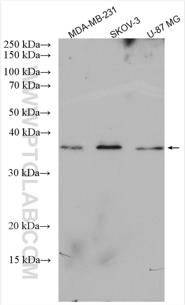 LUZP4 Antibody in Western Blot (WB)